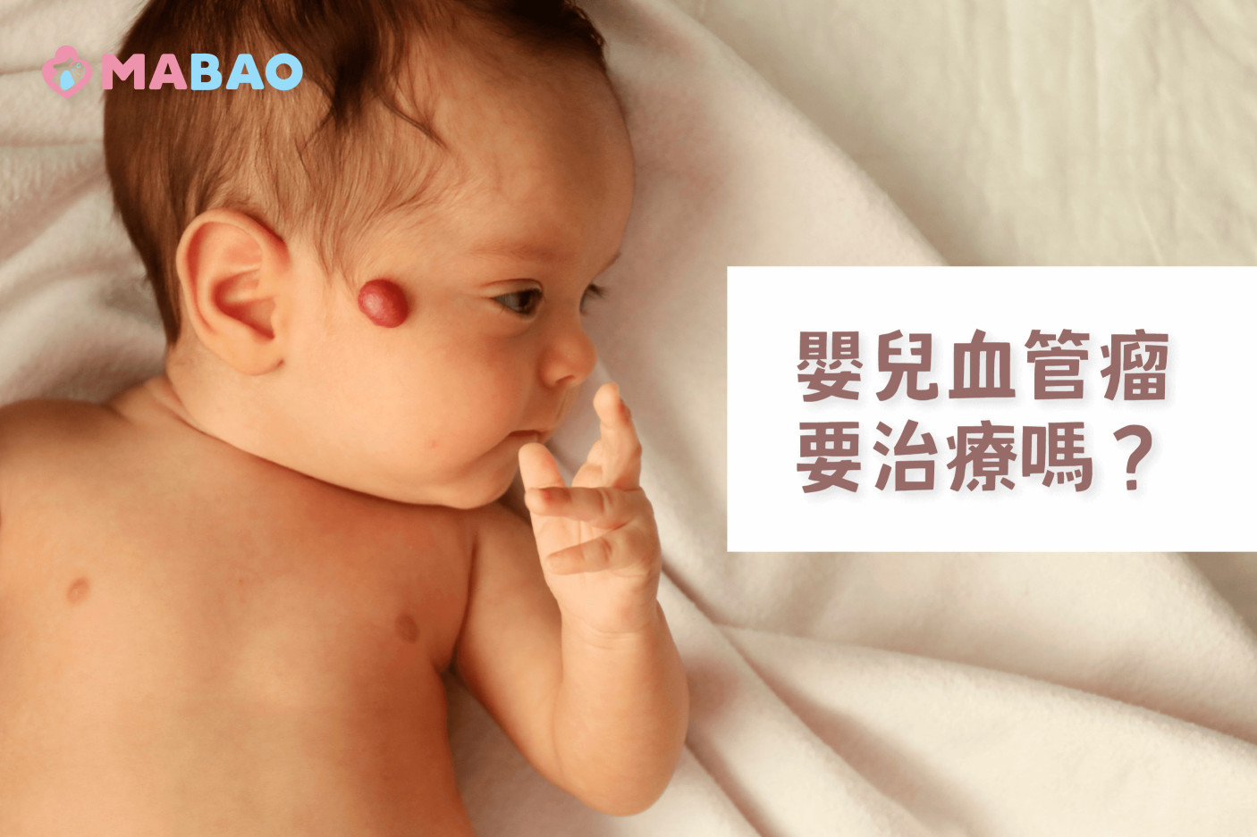 嬰兒血管瘤治療-3種情況需要治療
