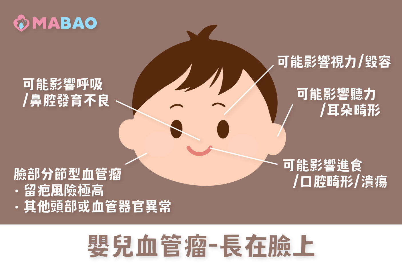 嬰兒血管瘤治療-長在臉部