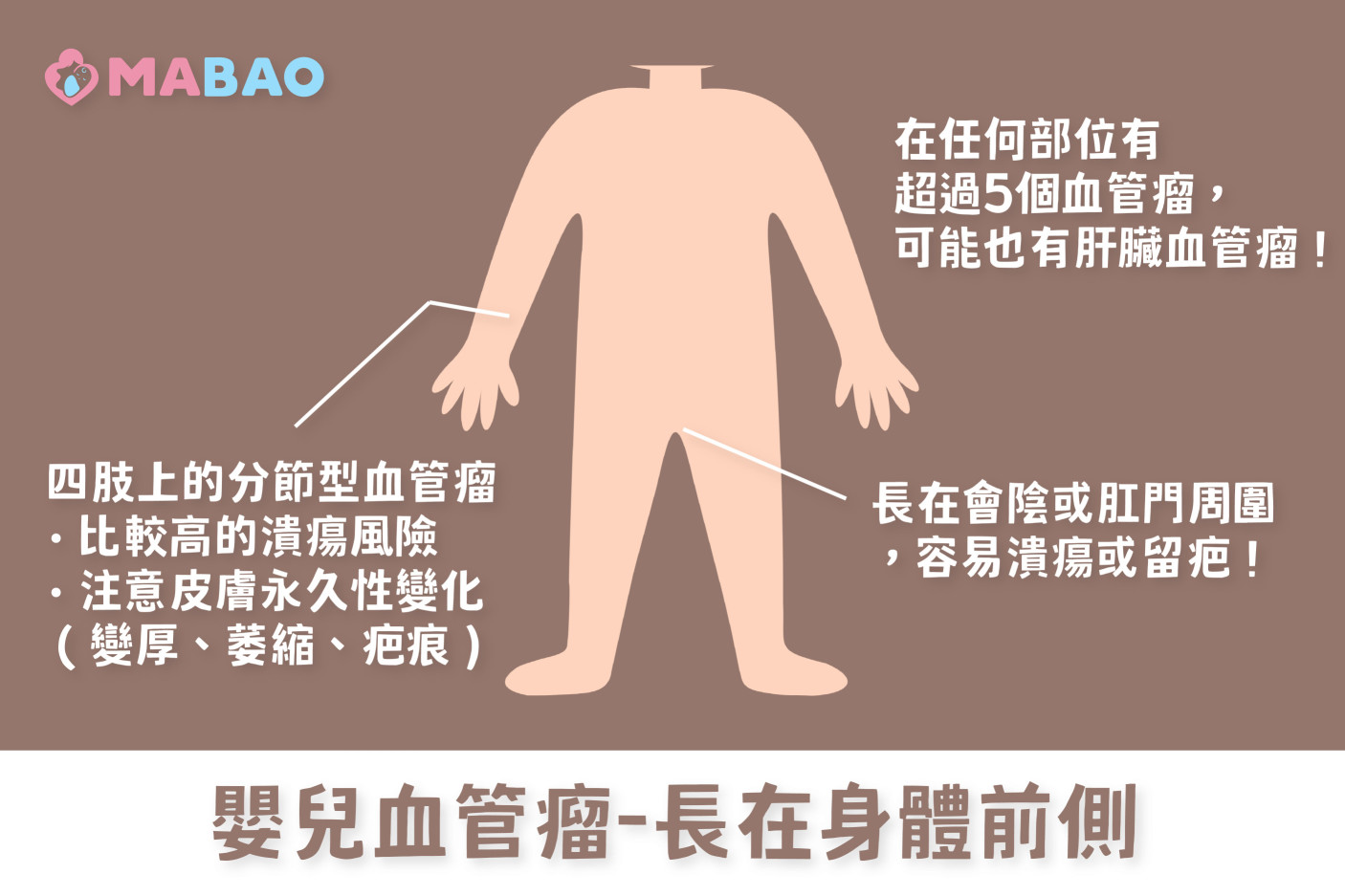 嬰兒血管瘤治療-長在身體前側