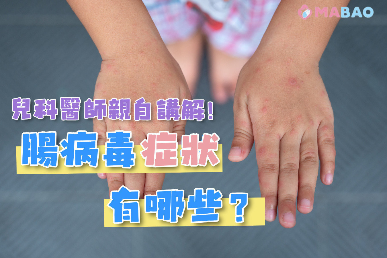 腸病毒感染症狀有哪些?兒科醫師帶你認識腸病毒 腸病毒感染症狀有哪些?兒科醫師帶你認識腸病毒